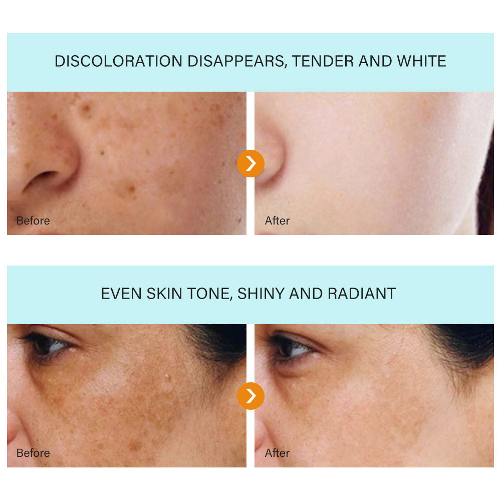 Dark spot removal face cream